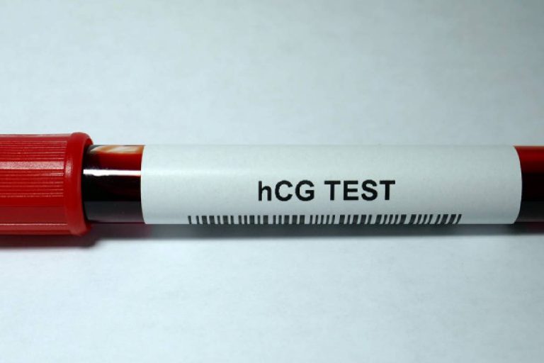 HCG