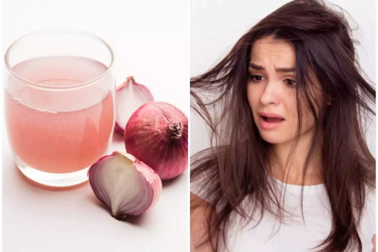 Onion Juice on Hair