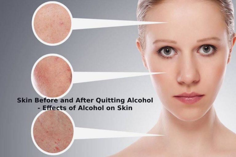 Skin Before and After Quitting Alcohol – Effects of Alcohol on Skin