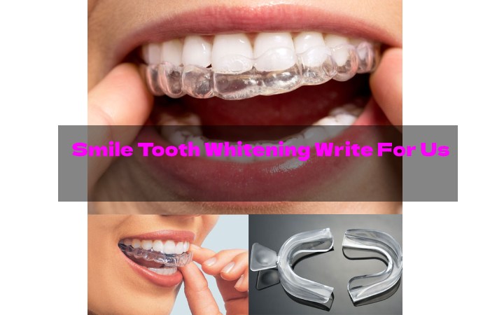 Smile Tooth Whitening Write For Us